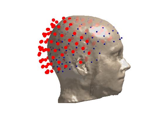 ../../_images/eeg_mri_alignment.jpg