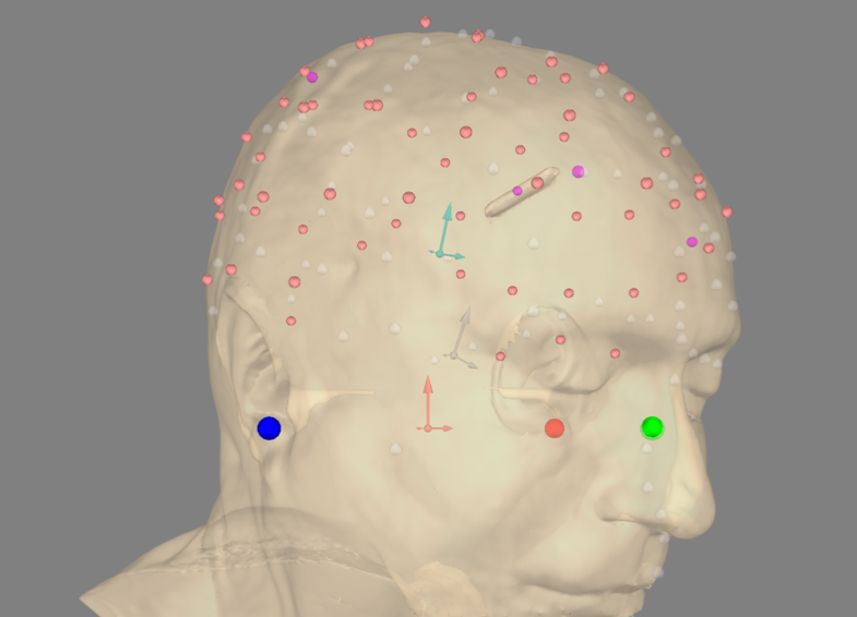 ../../_images/eeg_mri_alignment.png